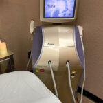 Alma Accent Laser Body Contouring machine at BodyCentre Wellness Suites in Anaheim, CA